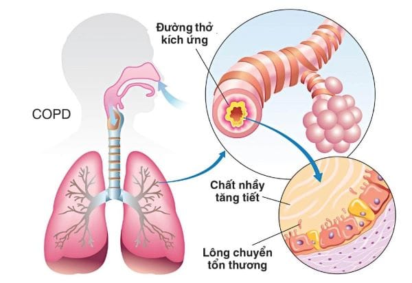 Thông qua hệ hô hấp